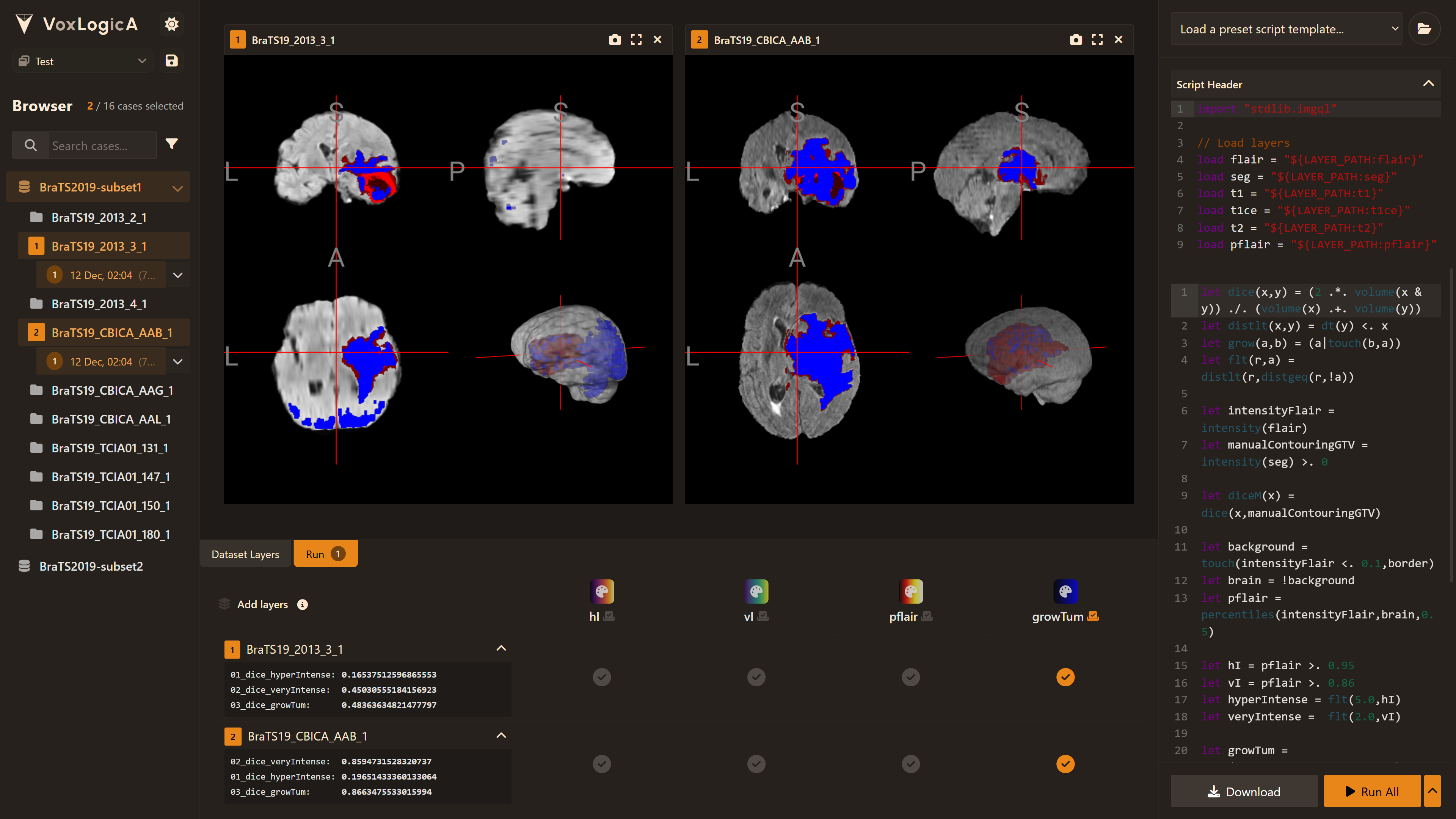 VoxLogicA UI Interface Preview - Dark Theme