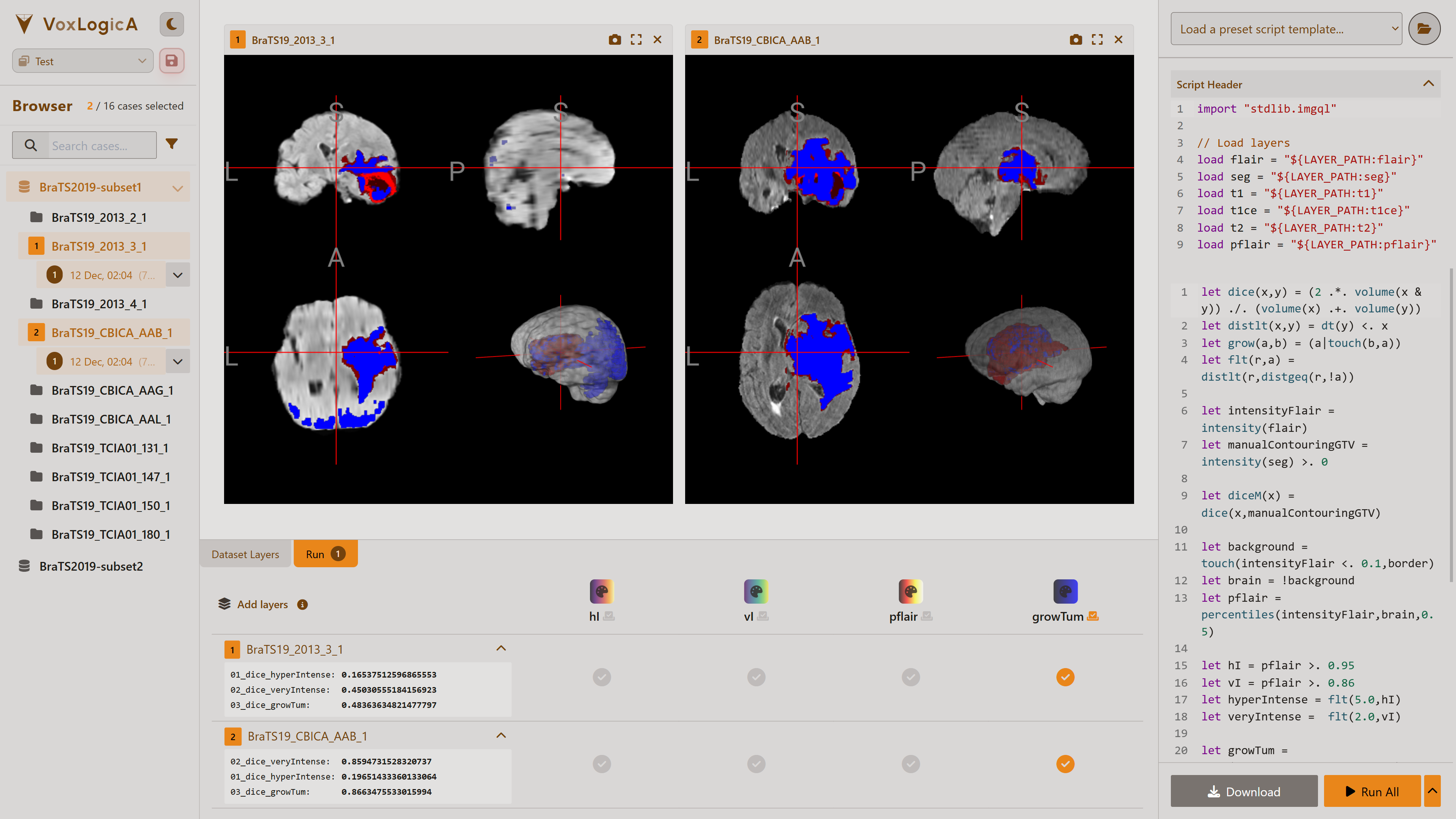 VoxLogicA UI Interface Preview - Light Theme