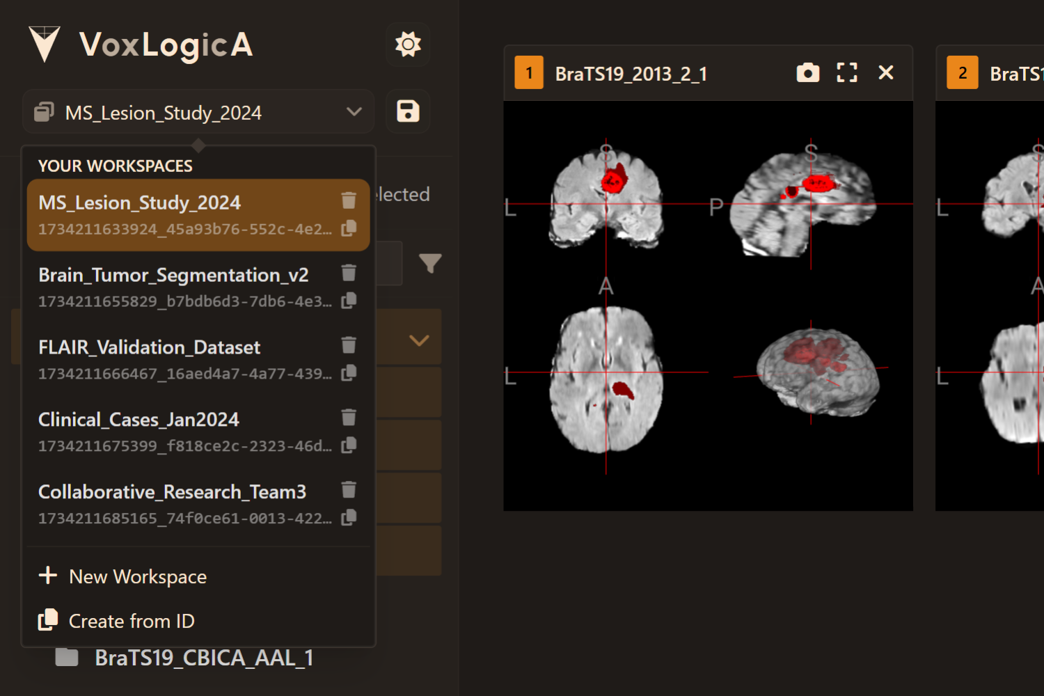 VoxLogicA UI Workspace Preview - Dark Theme