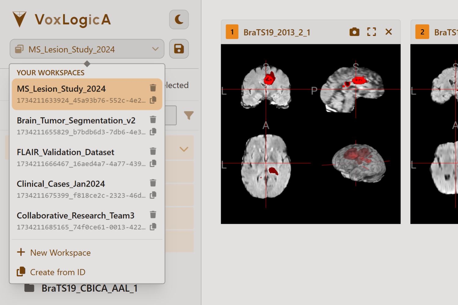 VoxLogicA UI Workspace Preview - Light Theme